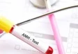 AMH Testi: Kadınların Üreme Sağlığını Değerlendiren Önemli Bir Test