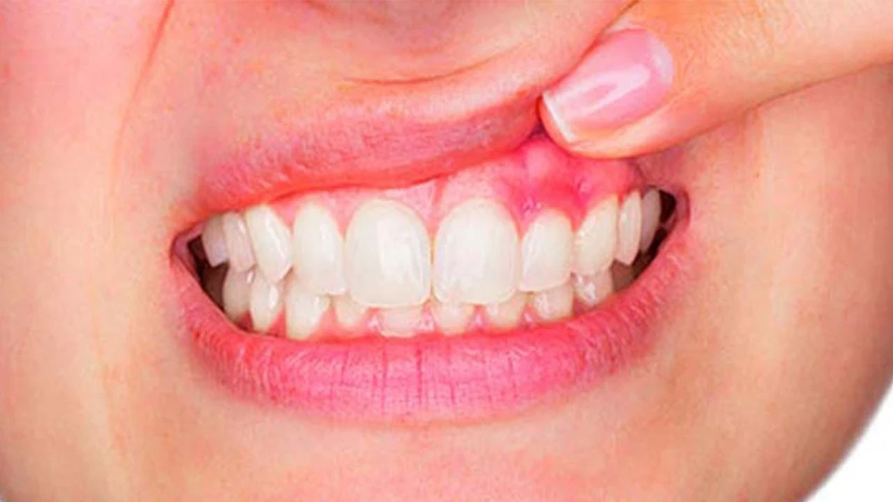 Apseye Dikkat: Belirtileri ve Riskleri Nelerdir?