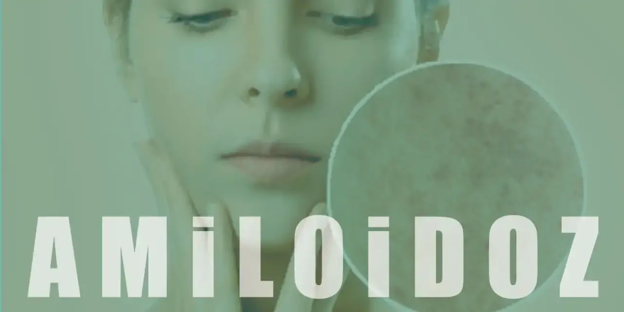 Amiloidoz Nedir? Organlarda Protein Birikiminin Etkileri ve Tedavisi