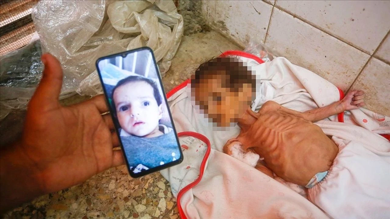 Gazze'de Abluka Kurbanı: Sağlıklı Bebek Mama Yokluğunda Hayatını Kaybetti