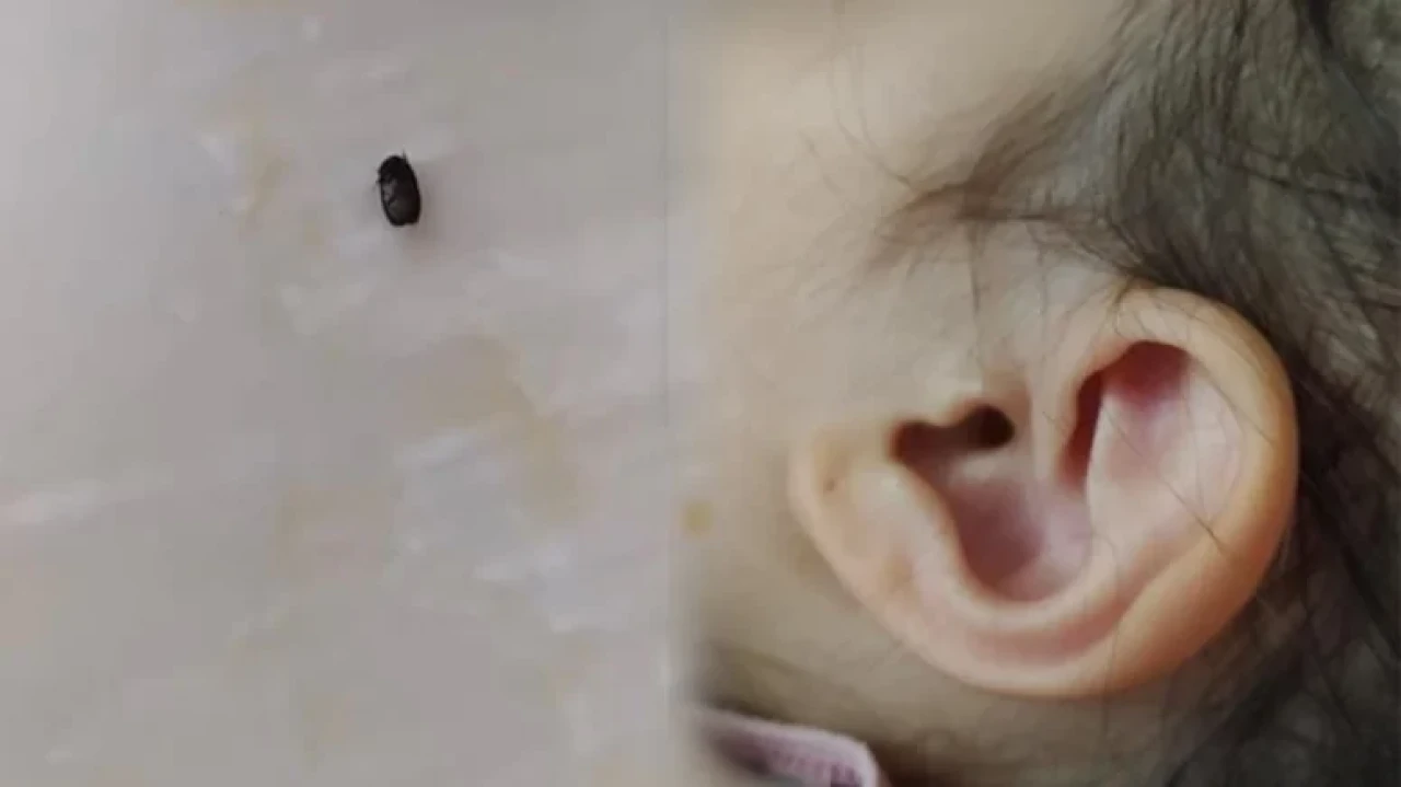 İzmit'te parkta oynayan 3 yaşındaki kıza kene yapıştı, sağlık durumu iyi