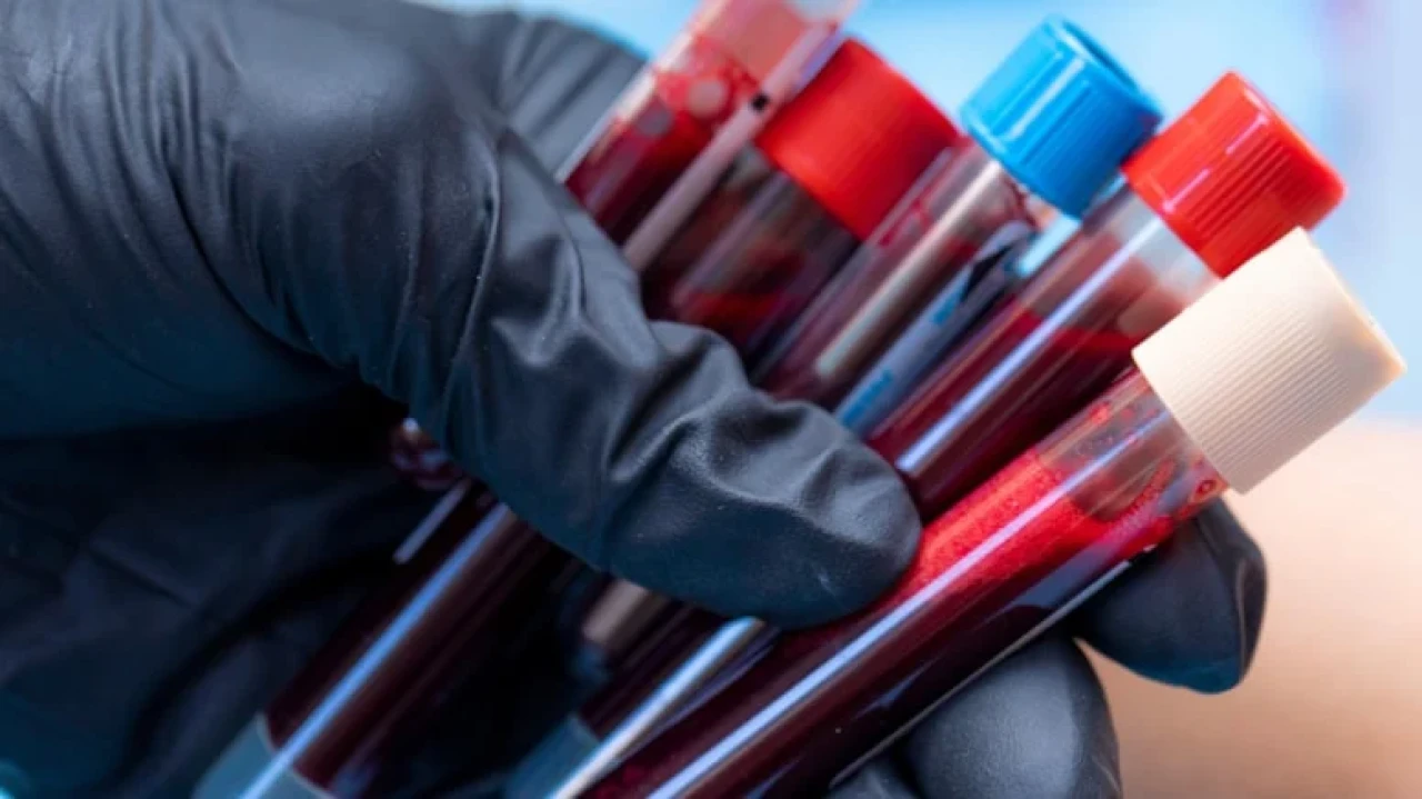 Alzheimer testi, kan analizleriyle yüzde 95 doğrulukla teşhis imkanı sunuyor