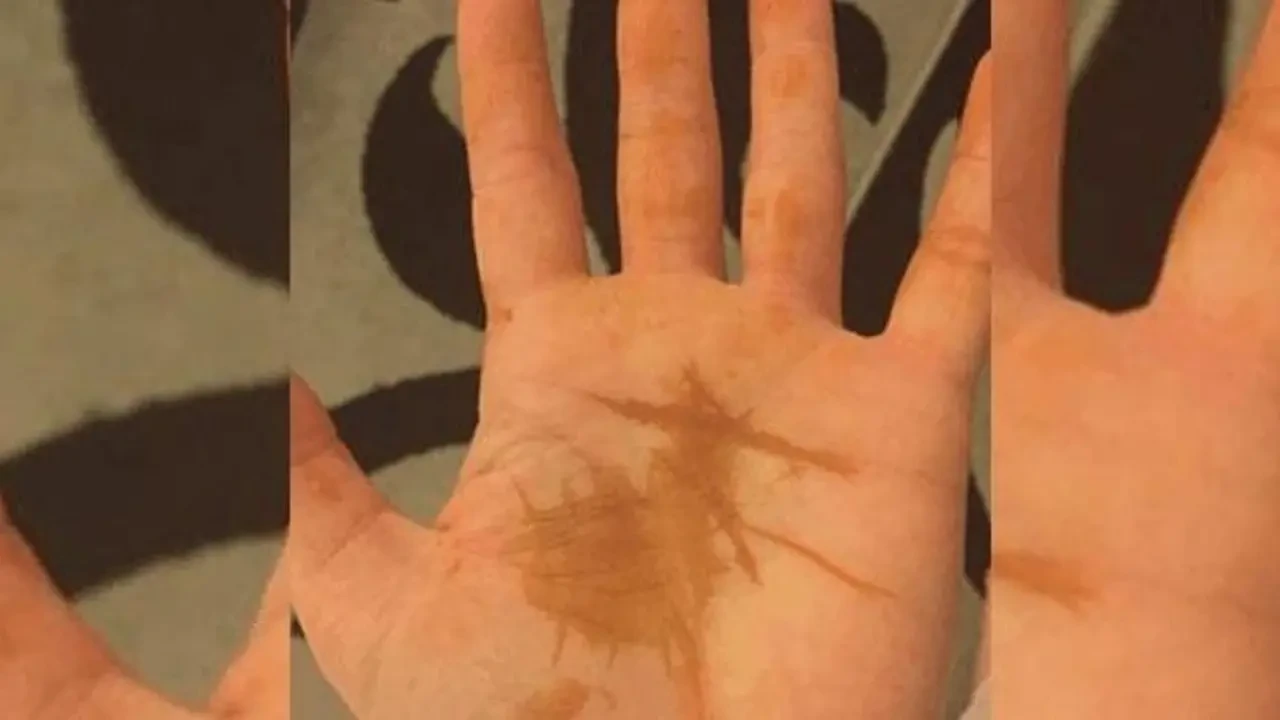 Uyandığınızda neden kına lekeleri oluşuyor? Bilinçaltı mı, mantar enfeksiyonu mu?