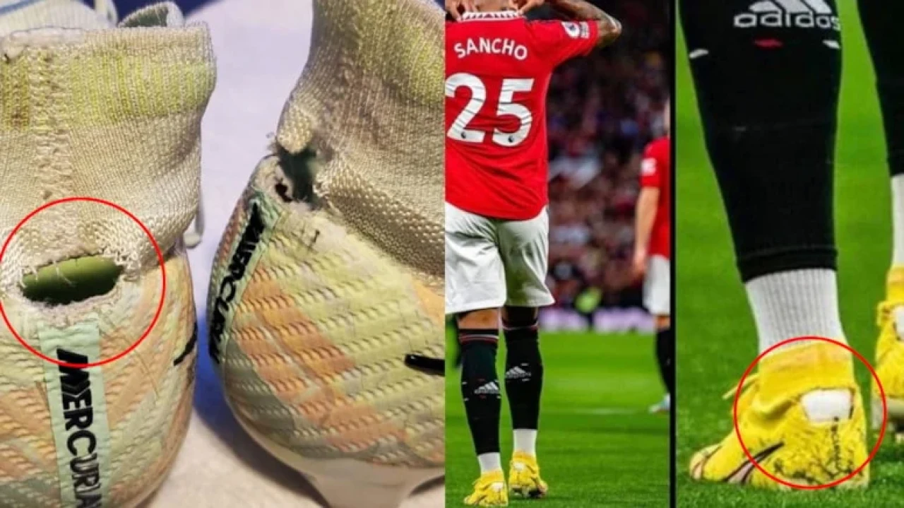 Futbolcularda Haglund Deformasyonu: Krampon modifikasyonu acil çözüm değil!