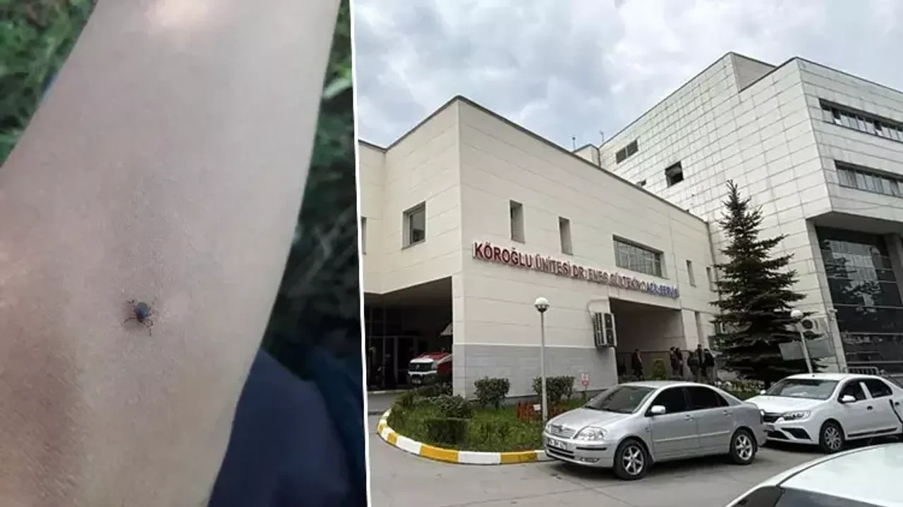 Kene ısırması sonucu 77 yaşındaki kadın hayatını kaybetti, Bolu'da ilk ölüm vakası kayıtlara geçti.