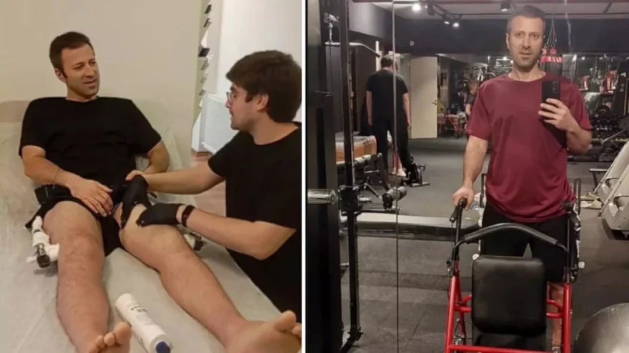 İstanbul'da bacaklarını kırdıran Gürcistanlı öğrenci 2 milyon TL ile 9.5 santim uzadı