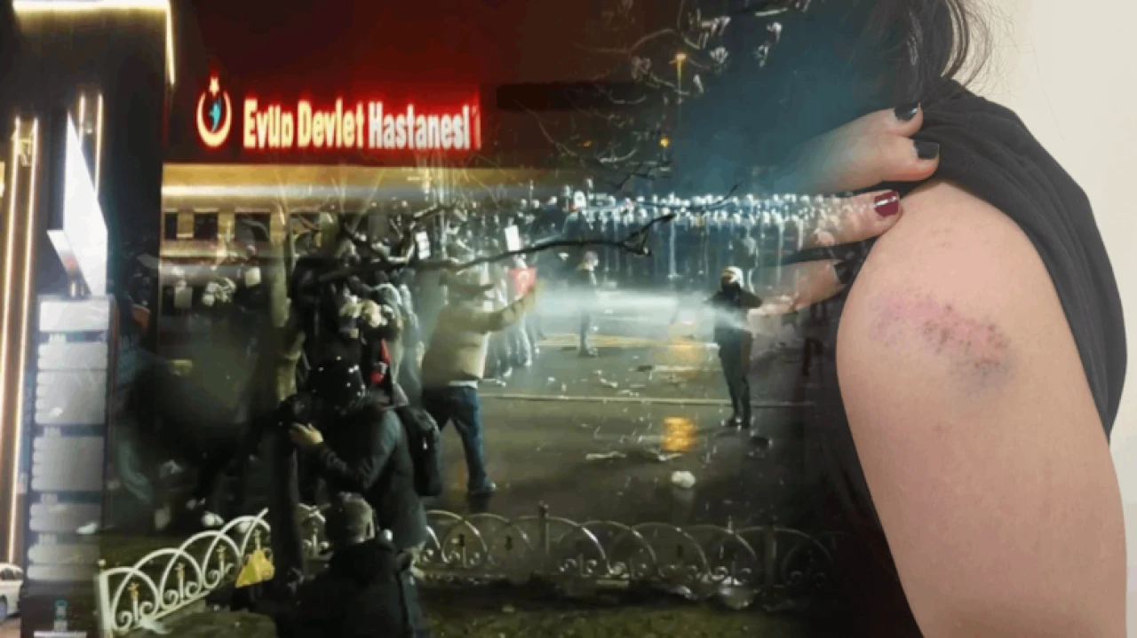 İmamoğlu'nun mitinginde gözaltına alınan öğrenciye şiddet: Aile suç duyurusunda bulundu