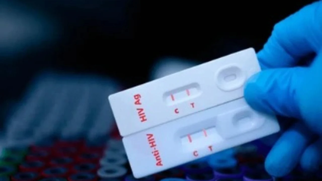 İzmir'de Ücretsiz HIV Test Merkezi Açıldı, Mahremiyet Ön Planda