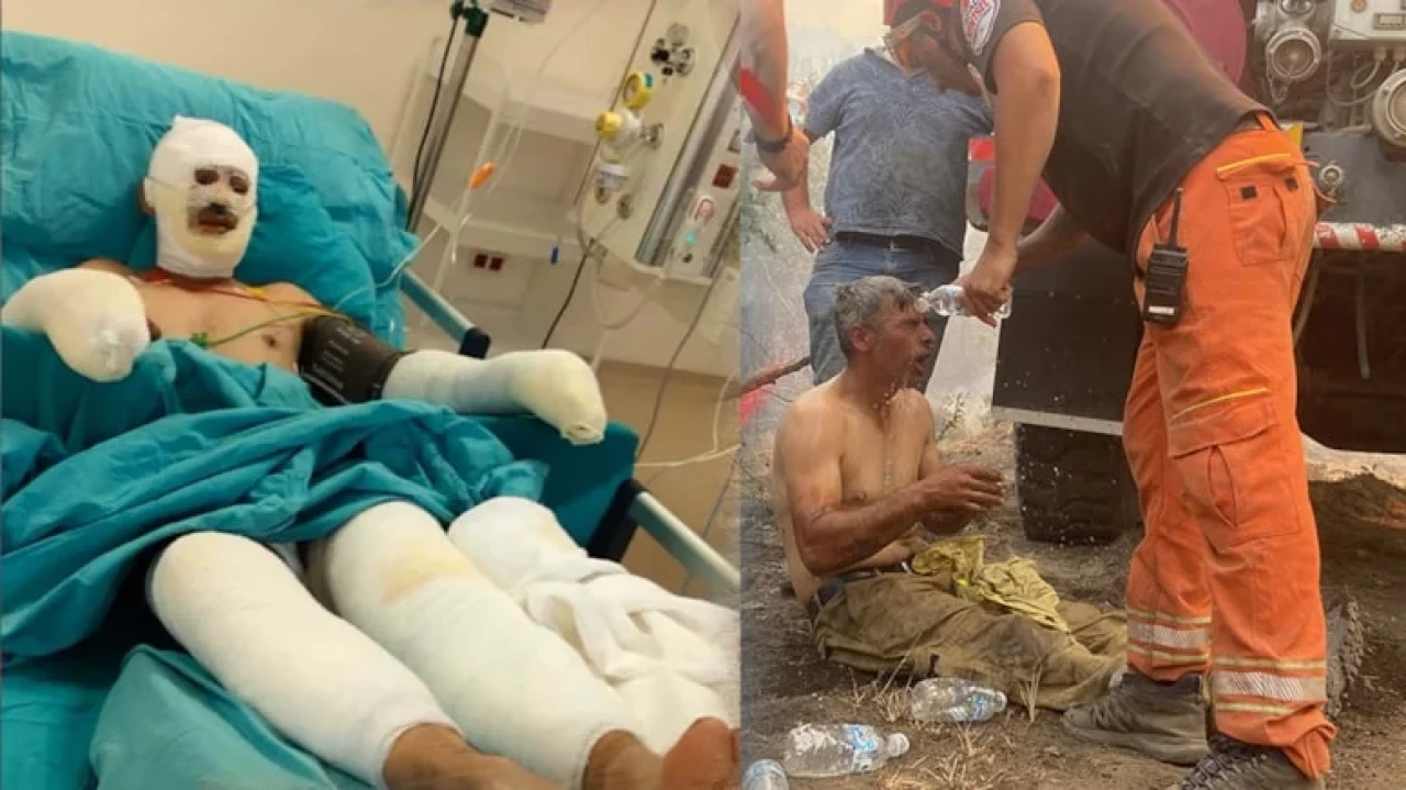 Seyitgazi'deki yangında yaralanan orman işçisinin tedavisi devam ediyor, hayati tehlikesi yok