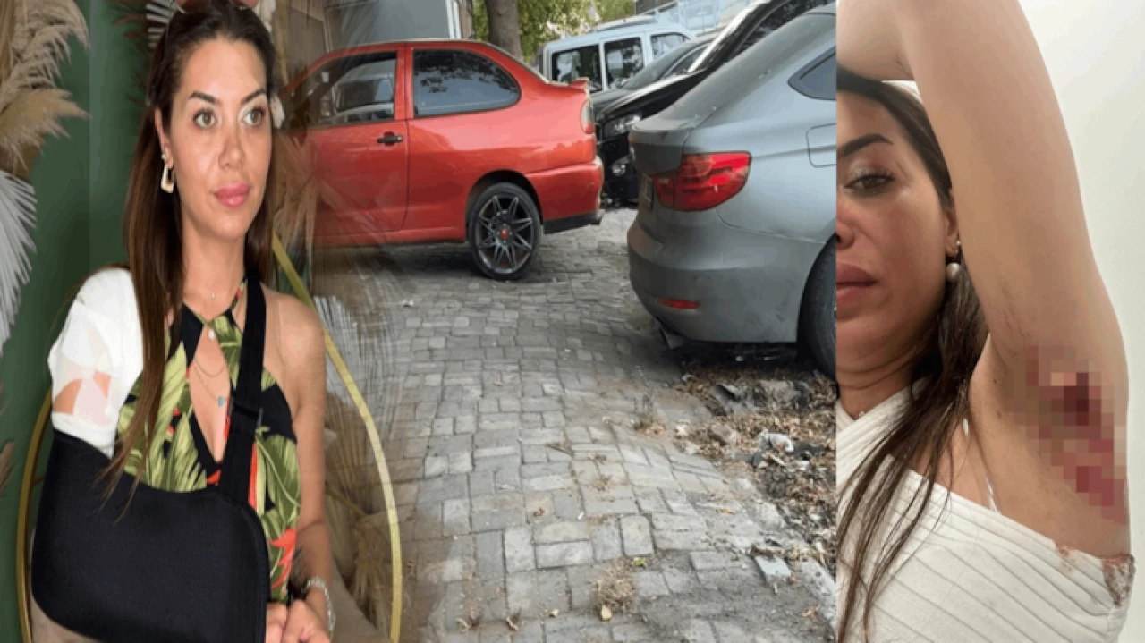 Aylin İmamoğlu, yağlı yolda düşüp yaralandı; iş yerini mahkemeye verdi!