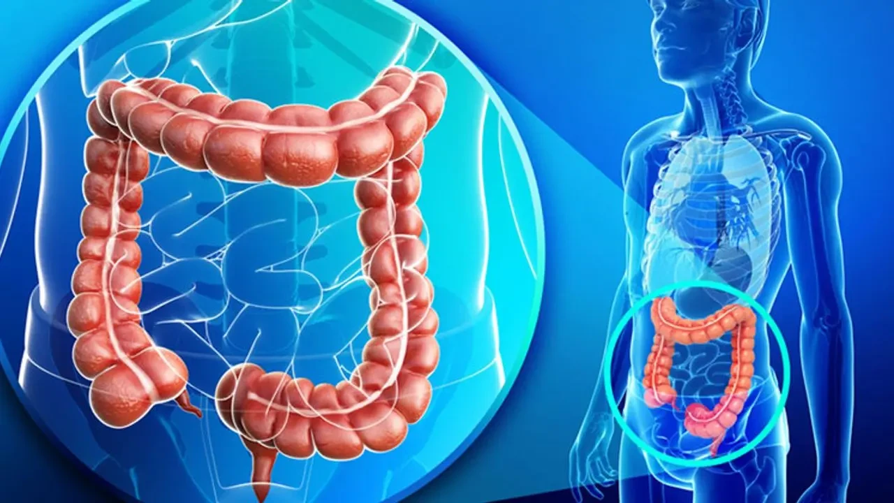 Bağırsak İltihabı ile İlgili Bilmeniz Gerekenler: Nedir ve Vücut Üzerindeki Etkileri Nasıl Olur?