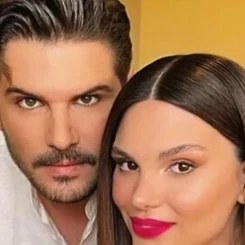 Almeda Abazi kimdir? Yaptırdığı estetikler merak ediliyor