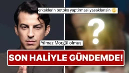 Norm Ender'in Yeni Klip Görüntüleri Telaşlandırdı: Botoks Spekülasyonları Gündeme Geldi!