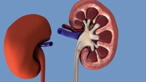 Böbrek Stentinin Ardından Görülen Kritik Belirtiler: Takipte Olun!