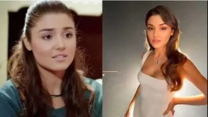 Estetik Operasyonlarla Görünümünü Değiştiren Türk Ünlüler Kimlerdir?