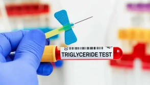 Trigliserit seviyeleri nasıl düşürülür? Trigliserit nedir?