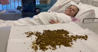 Manisa'da nadir ameliyat: 70 yaşındaki kadının safra kesesinden, yapay zekânın tahminine göre 20 binden fazla taş çıkarıldı