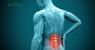 Maraşlı Çalışanlara Bambaşka Bir Destek: Bel Fıtığı Sebebiyle Tazminat ve Sürekli Maaş İmkanı!