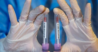 Hantavirüs: Küresel Salgın Riski Kapıda mı?