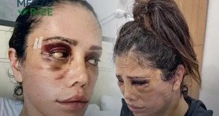 Didem Ceran, Estetik Operasyon Sonrası Şok Edici Açıklamalar Yaptı!