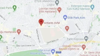 Antarese Nasıl Giderim