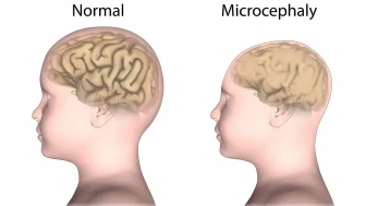 Halilişko'nun annesinin adı ne? Halilişko Hastalığı nedir? Ayşe Koşar'ın kocasının adı ne? Halilişko'nun kaç kardeşi var?
