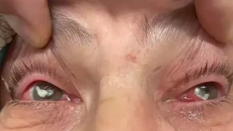 Şifa Arayışında Sıra Dışı Yöntem: Gözyaşlarıyla Gelen İyileşme!