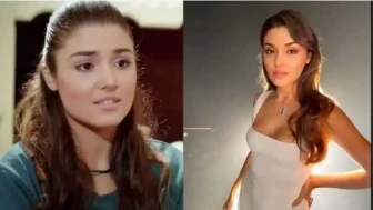 Estetik Operasyonlarla Görünümünü Değiştiren Türk Ünlüler Kimlerdir?