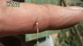 Arı iğnesi nasıl çıkarılır? Şişlik ve ağrı için dikkat edilmesi gerekenler