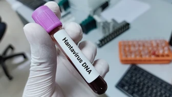 Dünyayı Tehdit Eden Hantavirüs için Acil Uyarı! Tedavi ve Aşı Geliştirme Sürecindeki Yenilikler