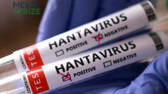 Hantavirüsün ilk belirtileri neler? Sessiz başlıyor, hayati tehlikeye dönüşebiliyor!