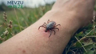 Kene Isırması ve KKKA Riski: Uzmanlardan 10 Gün Sürebilecek Tehlikeli Belirtiler İçin Uyarı!