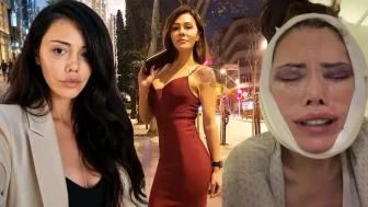 Didem Ceran Neden Yüz Nakli Yaptırdı? Güney Kore'de Hangi Operasyonları Geçirdi?