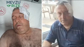 Aşı Hatırlatması Yapan Sağlık Görevlisine Saldırı: Yumruklu Saldırı Olayı!
