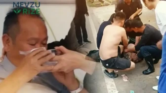 Kadını kurtarmak isterken dehşeti yaşadı! Saldırgan burnunu koparıp yuttu
