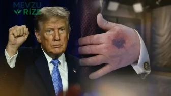 Boynundaki döküntü ve şişlik gündem olmuştu: Trump sağlık kontrolünden geçti