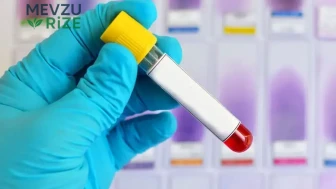 Alzheimer Riskini Belirleyecek Yeni Kan Testi Üzerinde Çalışmalar Sürüyor: Beklenen Tarih Ne?