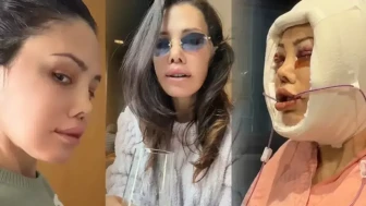 Didem Ceran’ın Estetik Operasyonları: Güzellik Yolculuğundaki Değişimler