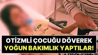 Elmas Yağmur Kimdir? Dövülen Otizmli Çocuk Nasıl?