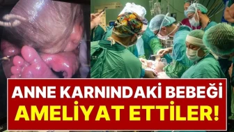 Anne Karnındaki Bebeği Ameliyat Ettiler