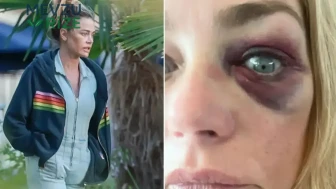 Mutlu yuvası kabusa dönüştü: Hollywood yıldızı evliliğindeki karanlık yüzü anlattı