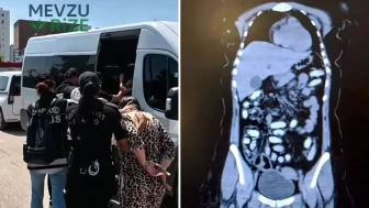 Mide Ameliyatı Gibi Yüzde 1,5 Kilo Metamfetamin Taşıyan İki Kurye Tutuklandı!