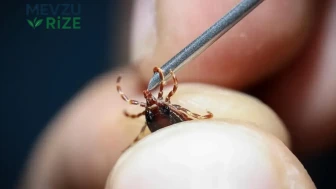 Sivas'ta KKKA Hastalığı Şüphesiyle Bir Kişi Hayatını Kaybetti