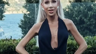Hande Demir Neden Bu Kadar Zayıfladı? Zayıflama İlacı İddialarına İlk Kez Yanıt Verdi