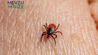Çorum'da Kene Tehdidi: Bir Kadın Hayatını Kaybetti