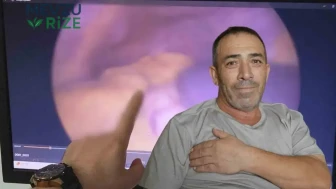 54 Yaşında Şaşırtıcı Bir Gerçekle Yüzleşti: Organları Ters Düzenlenmiş!