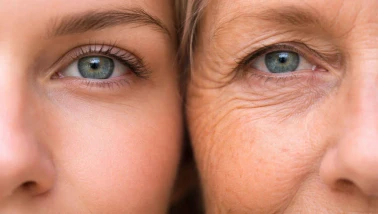 Bilim insanları 136 çalışmayı inceledi: Estetik uygulamalar gerçekten gençleştiriyor mu?