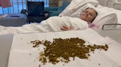 Manisa'da nadir ameliyat: 70 yaşındaki kadının safra kesesinden, yapay zekânın tahminine göre 20 binden fazla taş çıkarıldı