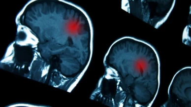 14 Yaşındaki Gençteki Baş Ağrıları Korkutucu Bir Hastalığın İşareti Oldu: 'Tarama Yapılmadı'