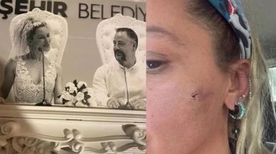 Yıldız Asyalı'dan Korkutucu İtiraf: Eşinden Şiddet Gördüğünü Açıkladı!